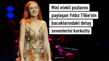Mini etekli pozlarını paylaşan Yıldız Tilbe’nin bacaklarındaki lekeler sevenlerini korkuttu.