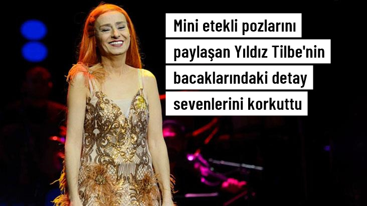 Mini etekli pozlarını paylaşan Yıldız Tilbe’nin bacaklarındaki lekeler sevenlerini korkuttu.