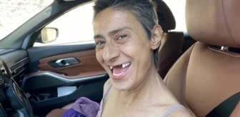 Tedavi gören Yıldız Tilbe dişsiz halini paylaştı